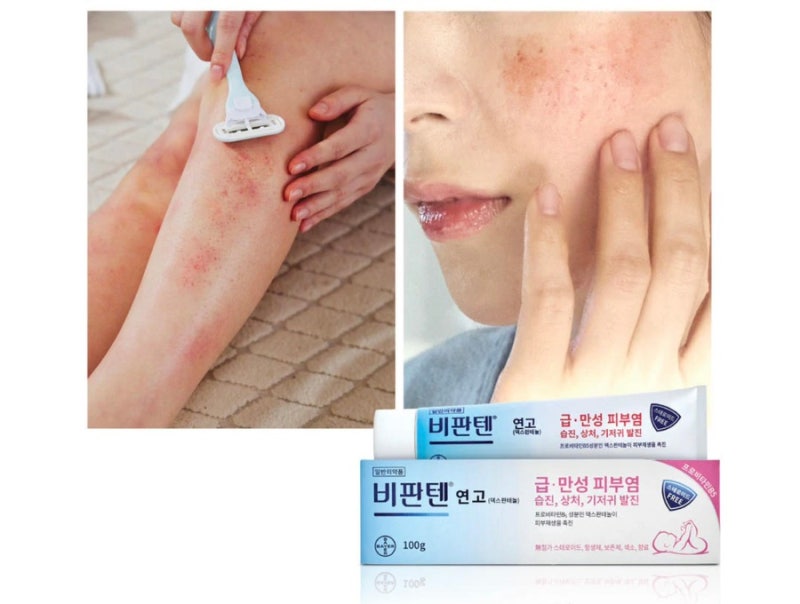비판텐 목주름 효과와 사용법, 진짜일까?