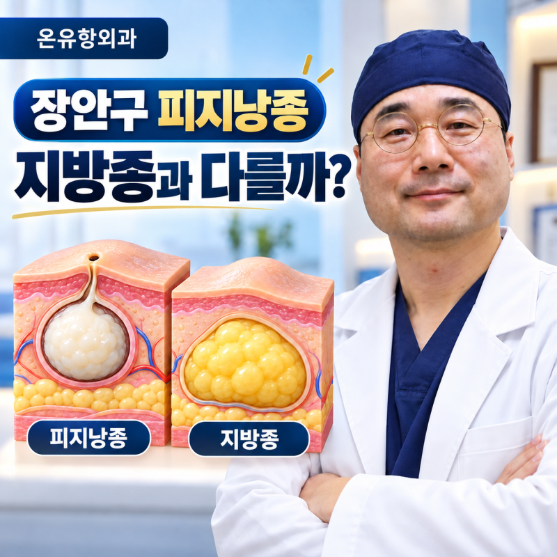 장안구 피지낭종, 피부에 생긴 멍울이 지방종과 어떻게 다를까요?