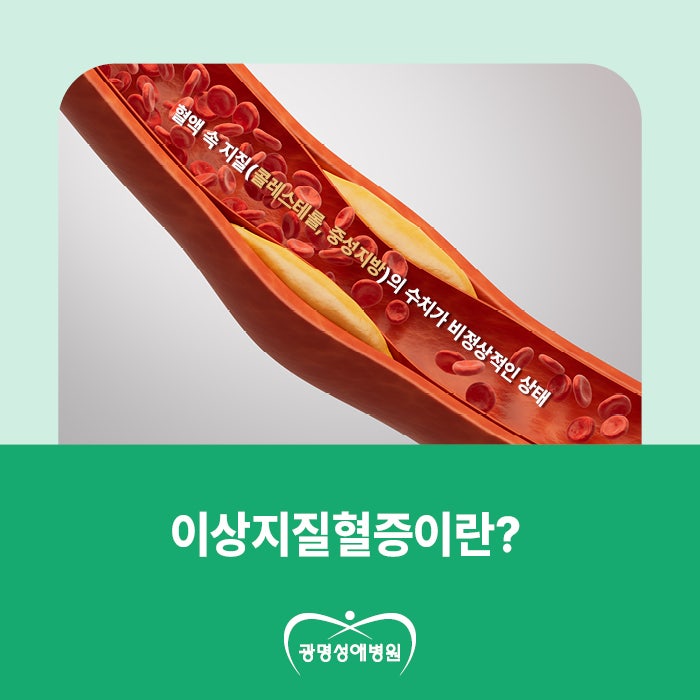 "뚜렷한 증상이 없어요.." 성인 2명 중 1명이 앓는 이상지질혈증