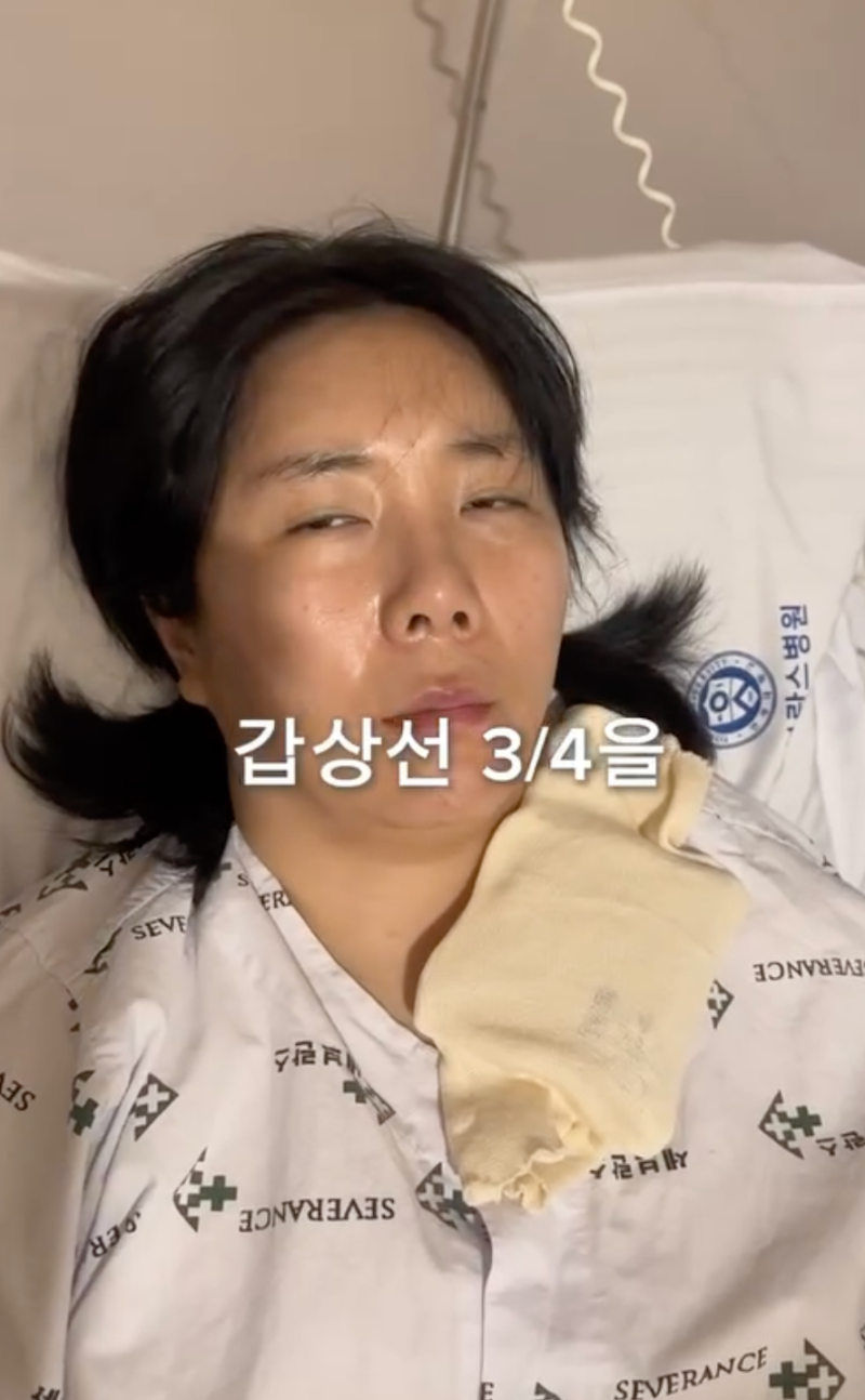 코미디언 허안나 "41세 갑상선 75% 제거, 누워 있어도 피곤하다" 종양 수술 후 의료진이 전한 ....