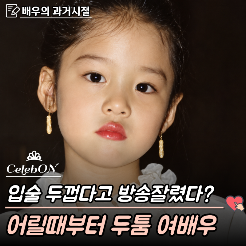 "입술 두껍다고 방송 잘린 배우"... 광고 속 한마디로 인생이 달라진, 지금은 누구나 아는 전....