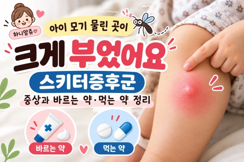 아이 모기 물린 곳이 크게 부었어요｜스키터증후군 증상과 바르는 약·먹는 약 정리