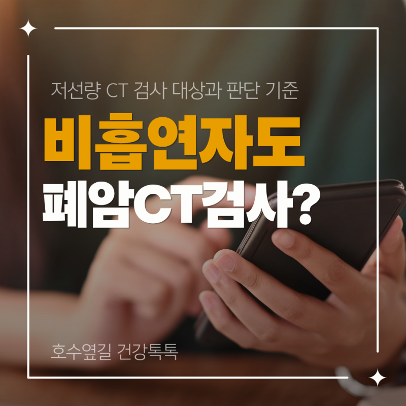 비흡연자도 폐암 CT 검진 받아야 할까? 저선량 CT 검사 대상과 판단 기준