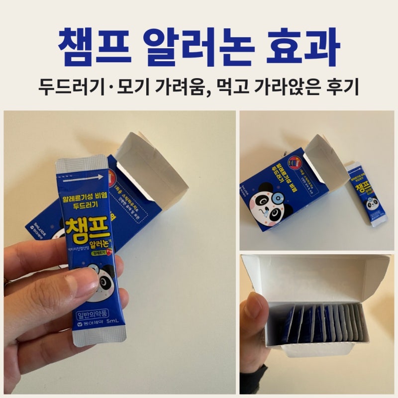 챔프 알러논 효과 아이 두드러기,모기 물린 가려움에 먹고 가라앉은 후기