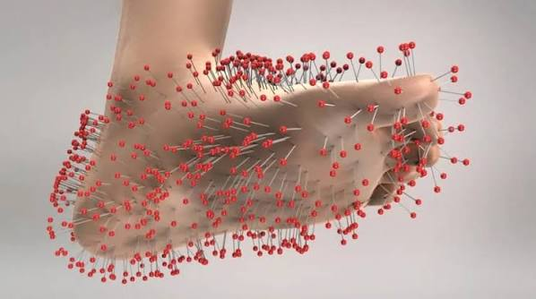 말초신경병증 Peripheral neuropathy: 말초신경병증 의료진·병원·약국·연구자 플랫폼