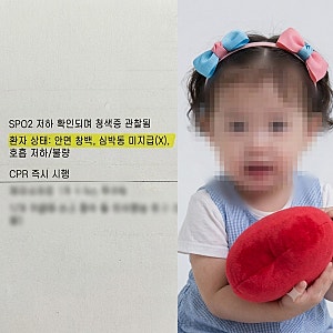 안과 마취 중 여아 사망,울산 안검내반 눈 수술 하던 27개월 사고 의료진 입건