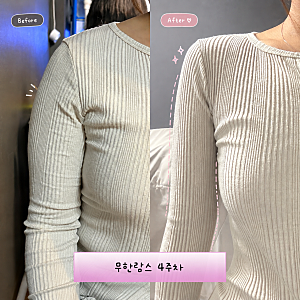 무한람스 4주차 팔뚝라인 만들기(뭉침, 통증, 후관리 등)