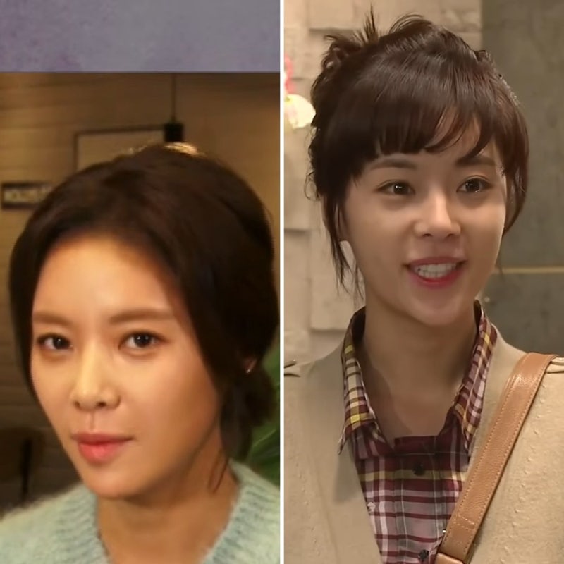 “웃으면 조커가 된다” 황정음, 리프팅 후 얼굴 직접 설명