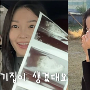 전진·류이서, 시험관 임신 후 유산 소식…아이에게 전한 고마움