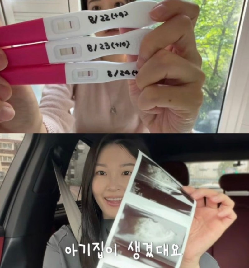 전진♥류이서, 시험관 임신 후 유산 고백…“잠깐이라도 찾아와 준 아기에게 고맙다”