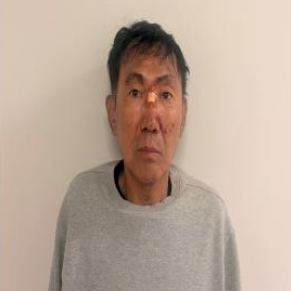 인천 구월동 흉기난동범 최충락 신상공개…8명 부상·19세 여성 의식불명, 전과 10범 확인