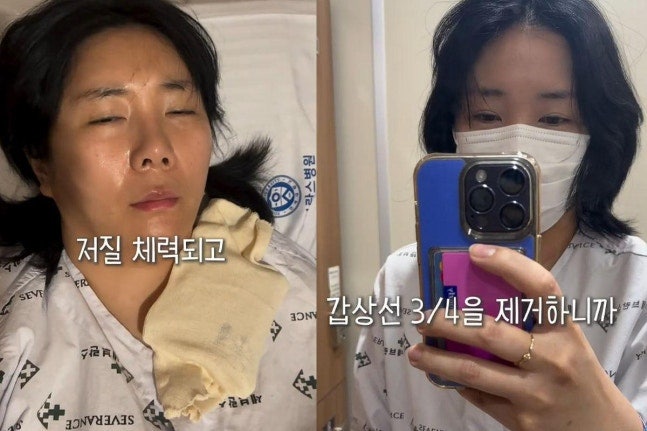 허안나, 갑상선 75% 잘라냈더니…누워 있어도 피곤하다는 고백