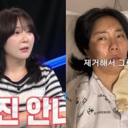 “10kg 빠져 예뻐졌다더니, 목의 혹 수술 뒤 피로가...” 개그우먼 허안나 씨의 갑상선 근황