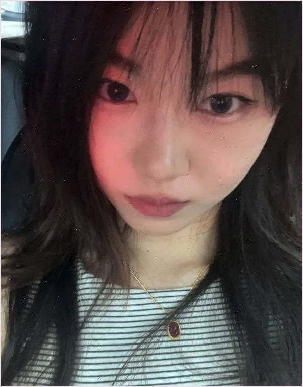 비판텐 밤 6주차 지금 내 피부