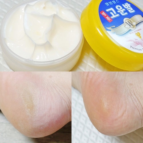 발뒤꿈치각질제거 풋크림 고운발크림, 사용 효과 높이는 꿀팁