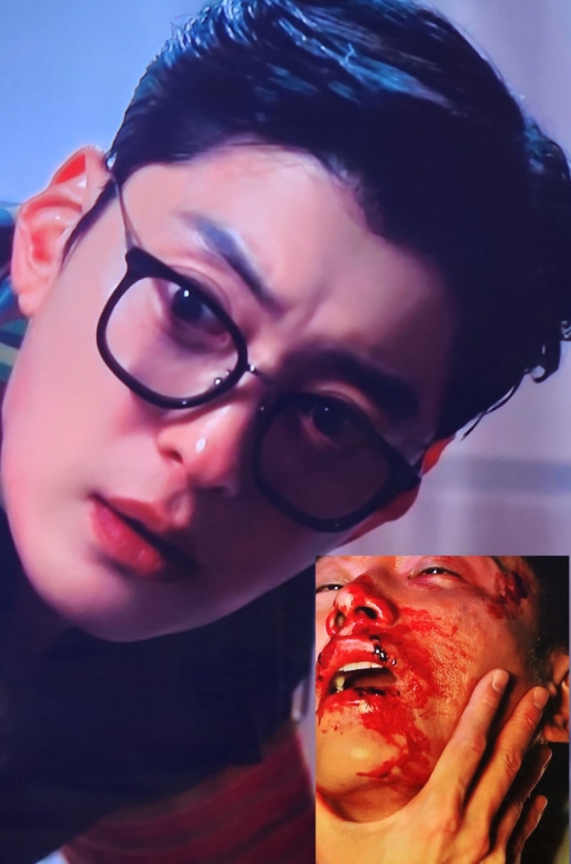 나대일은 악마다! 닥터X 4화 이니셜 새긴 거 실화? (sbs 금토드라마)
