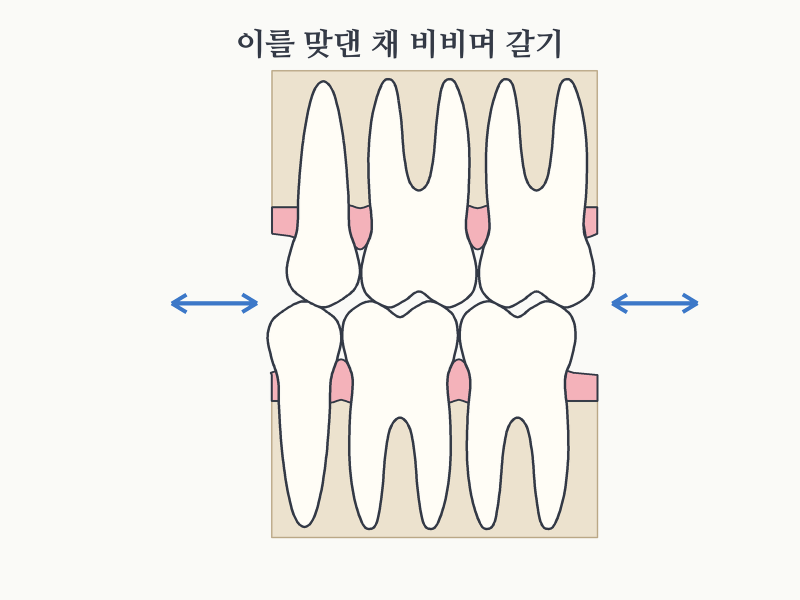 이갈이 원인, 자는 동안 이를 가는 이유와 오래 쓰는 법