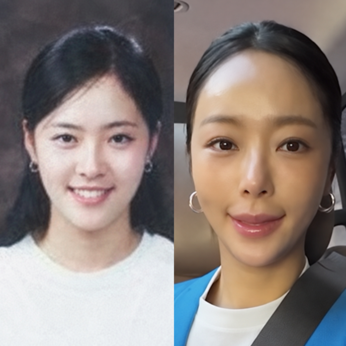 황정음 리프팅, 조커는 잠시뿐 | 귀족수술 빼고 당기는 시술 택한 진짜 이유