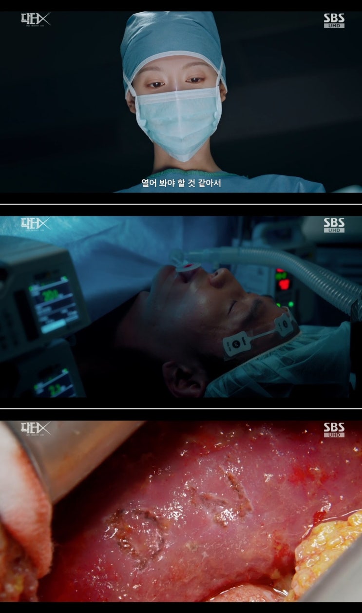 <b>장승조</b>, ‘<b>닥터X</b>’서 환자 몸에 이니셜 새긴 <b>사이코패스</b> 빌런 정체 ....