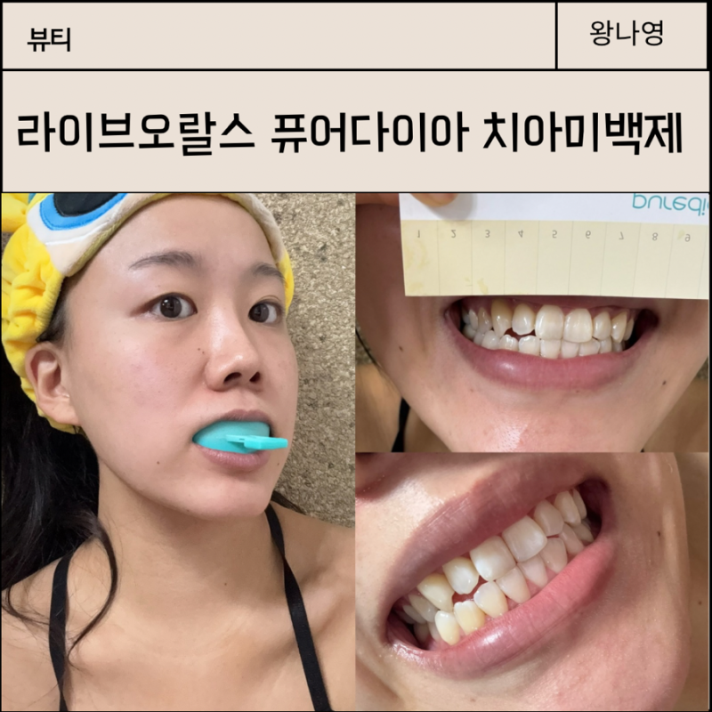 라이브오랄스 퓨어다이아 치아미백제 후기, 마우스피스 홈케어 사용법 정리