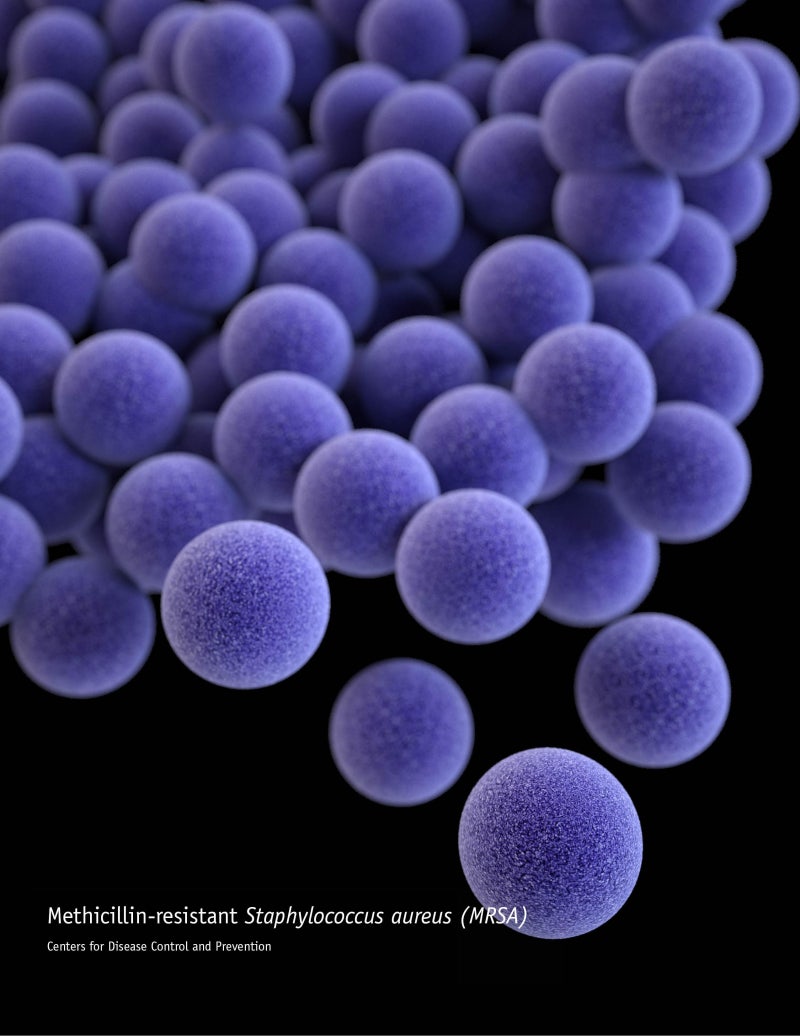 메티실린 내성 황색포도알균 감염(MRSA)이란? 증상부터 치료·예방법까지 총정리｜항생제 내....