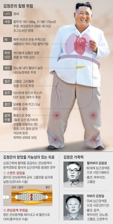 <b>김정은 사망설 반박</b> 총정리 | 셰완쥔 X 게시글 '뇌출혈 <b>사망</b>' 주장부....