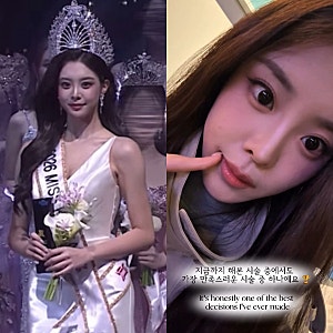 우지원 딸 우서윤 성형 논란에 입 열었다? 미스코리아 진이 밝힌 치아 시술