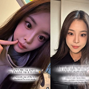 우지원 딸 우서윤 성형설 이후 치아 시술 고백…2026 미스코리아 진 “웃을 때 자신감 생겨” ....