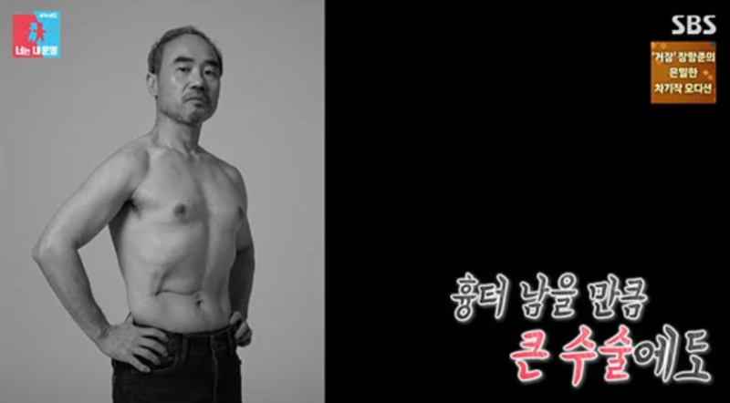 강신일, 47세에 간암 진단…수술 2주 만에 복대 차고 촬영장 복귀한 이유