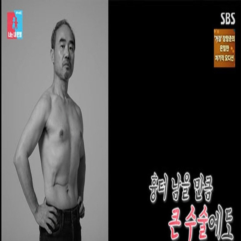 47세 간암 투병 강신일, 빚 때문에 수술 2주 만에 복대 차고 촬영 강행!