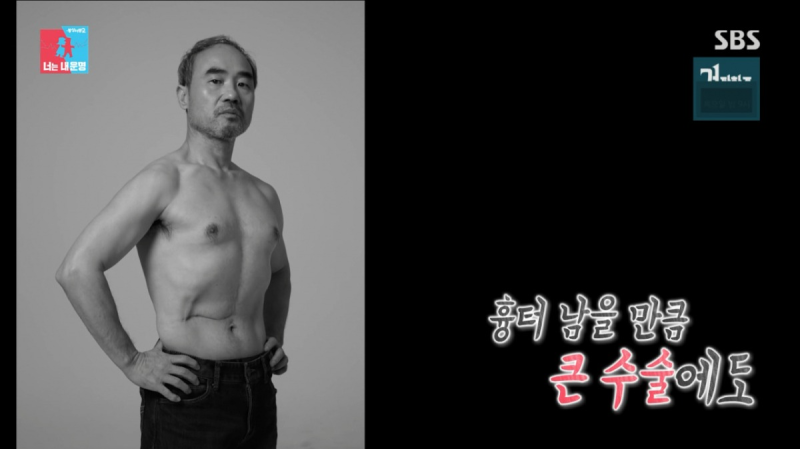 “수술 2주 만에 복대 차고 촬영장으로” 47세에 간암 판정 받은 강신일