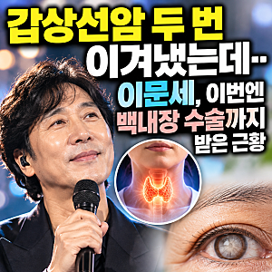 “갑상선암 두 번 이겨냈는데…” 이문세, 이번엔 백내장 수술까지 받은 근황