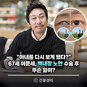 “아내를 다시 보게 됐다?” 67세 이문세, 백내장 노안 수술 후 무슨 일이?