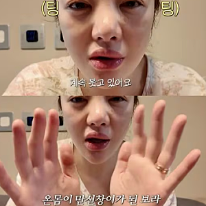 “시험관 주사 맞고 얼굴 퉁퉁에 두통까지?” 원진서·황보라가 털어놓은 난임 시술 부작용....