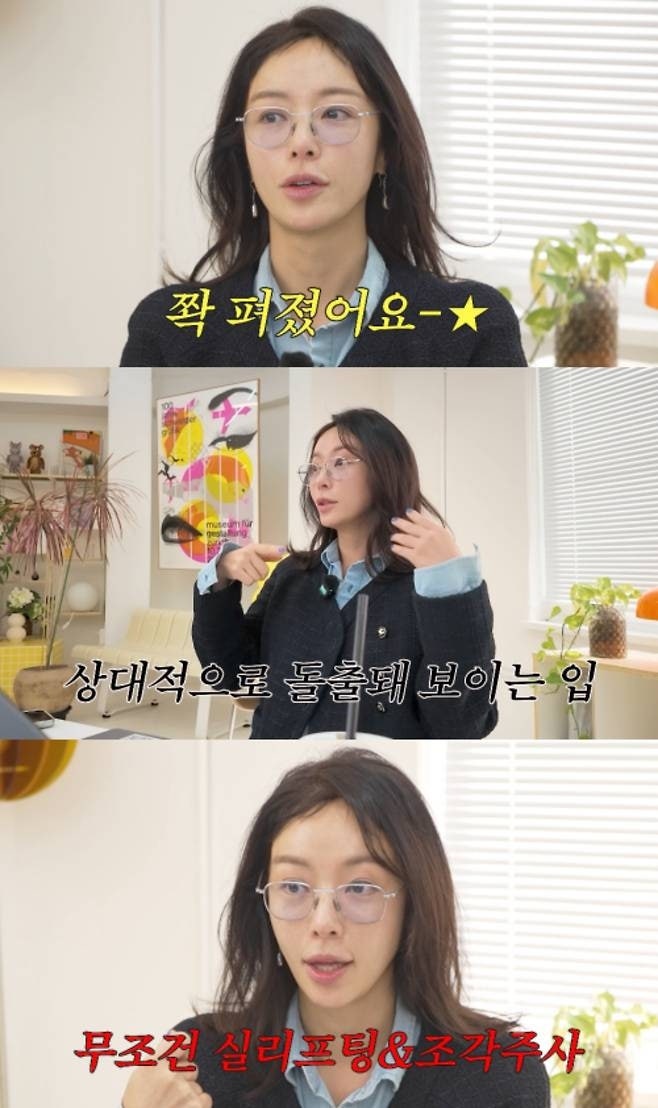 "다리미로 다린 듯"…황정음, 팔자주름 쫙 폈는데 '오리입' 부작용