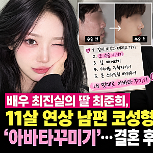 배우 최진실의 딸 최준희, 11살 연상 남편 코성형 체중감량 '아바타꾸미기'…결혼 후 달라진 ....