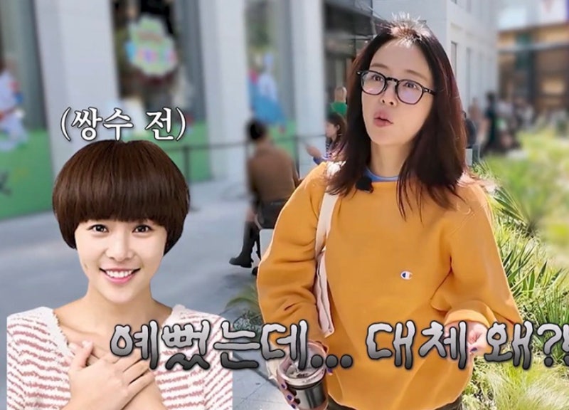 “2천만원 썼는데 복구는 2억”…황정음 성형 고백에 의사가 짚은 뜻밖의 변화