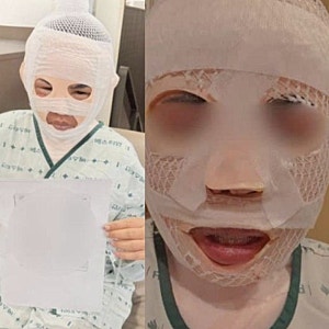 '잠든 아내 얼굴에 끓는 물' 40대 남편, 2심서 징역 3년으로 감형…'합의 반영'