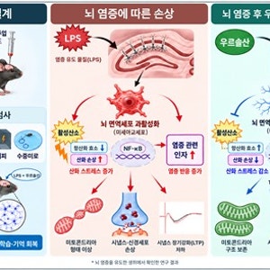 사과껍질 속 '우르솔산', 뇌 염증 줄이고 기억력 지킨다