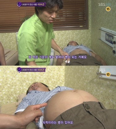 이수근의 올챙이배는 '식적' 이라는 병때문에 부풀어 오른것